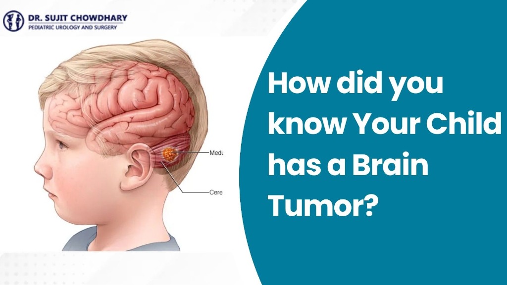 How did you know Your Child has a Brain Tumor - Child Brain Anatomy and Tumor Signs