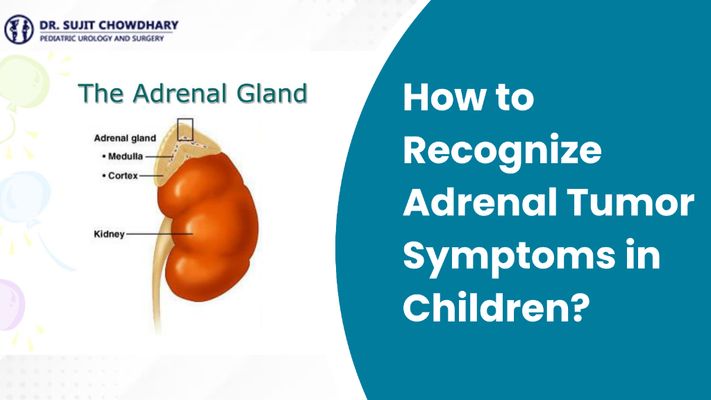 How to Recognize Adrenal Tumor Symptoms in Children - The Adrenal Gland Anatomy & Pediatric Urology Guide