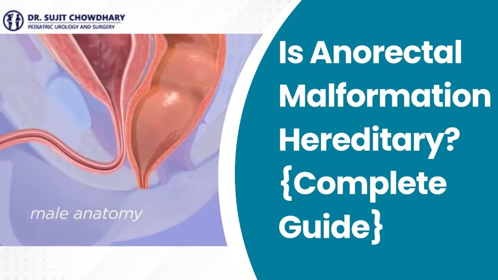 Is Anorectal Malformation Hereditary? {Complete Guide}