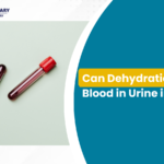 Can dehydration cause blood in urine in children shown with blood sample test tubes representing hematuria diagnosis